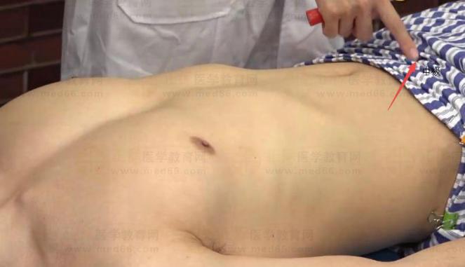 中西医助理医师实践技能针灸常用腧穴：任脉（中极）